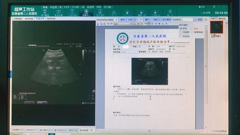 家族性癌症基因检测：了解这些，避免误判**